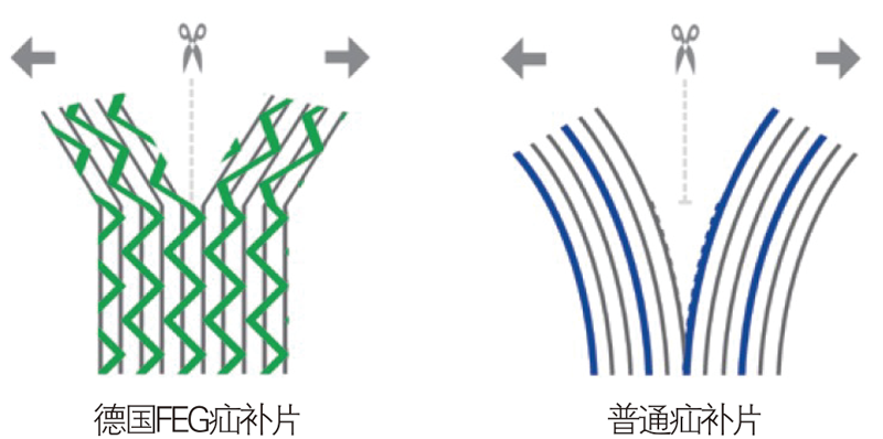 德國PVDF材質(zhì)疝氣補(bǔ)片-IPST