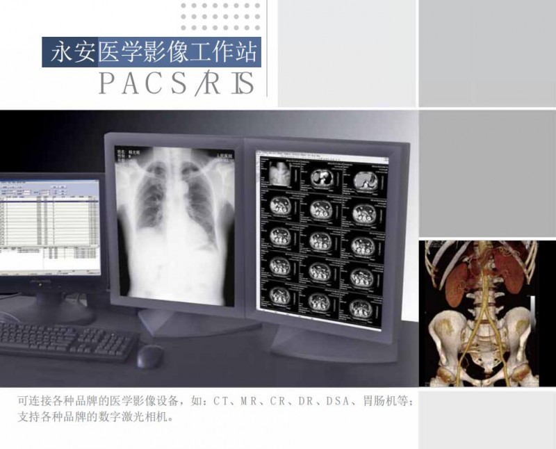 影像工作站（超聲、DR、CT、核磁）軟件廠家