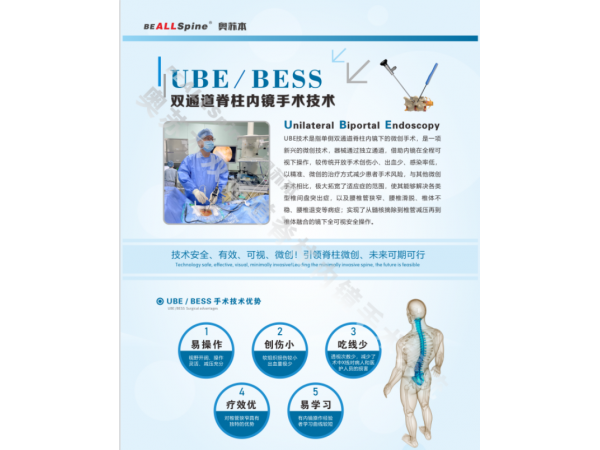 山東奧蘇本UBE雙通道脊柱內(nèi)鏡微創(chuàng)手術(shù)系統(tǒng)的技術(shù)