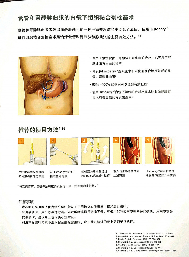 貝朗組織膠水2