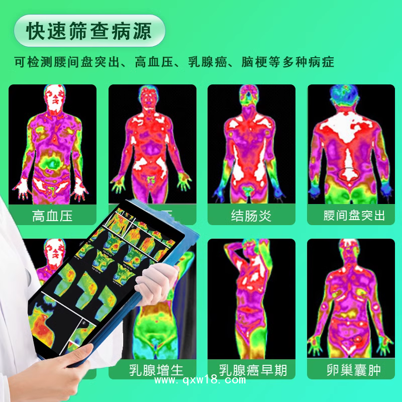 中醫(yī)熱ct體質(zhì)健康測試儀醫(yī)用紅外線成像儀透視機(jī)CT醫(yī)用成像儀
