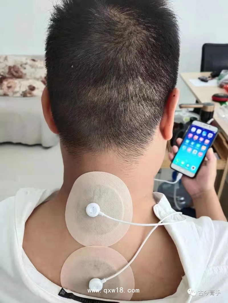 手機智能膏藥——響應國家號召，引爆地攤經(jīng)濟