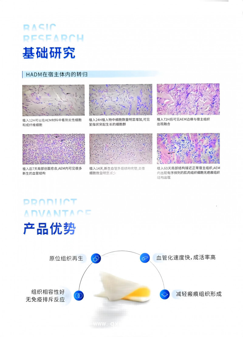 脫細(xì)胞異體真皮基質(zhì)軟組織補片