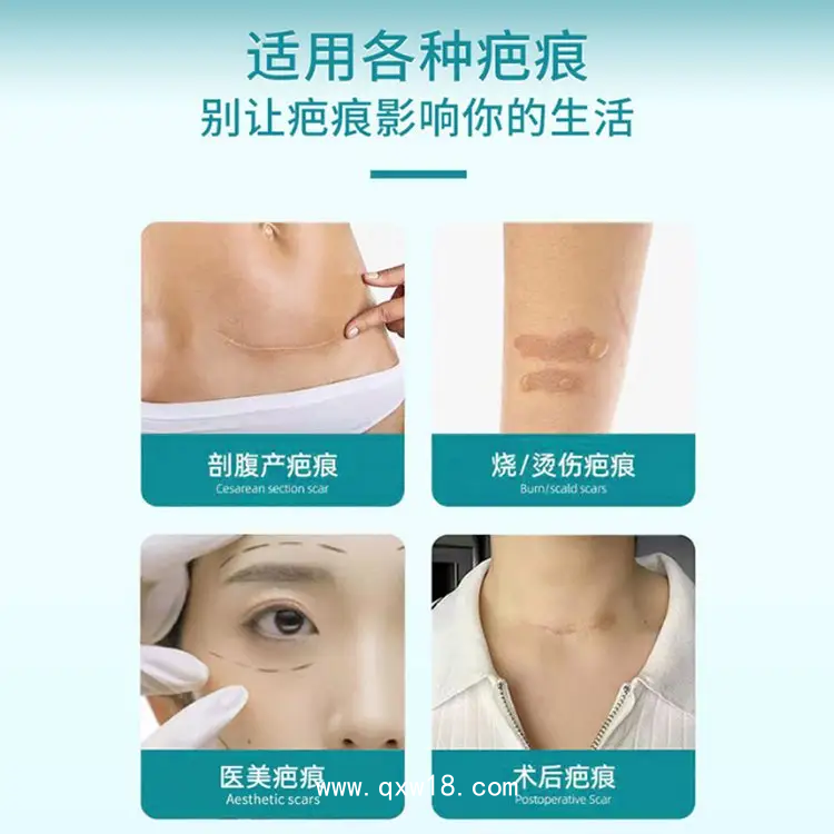 疤痕貼 巴痕痘疤燒傷疤修復 正規(guī)資質 膚色透明均可加工定制廠